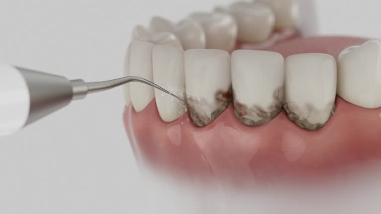Trusted Invisalign Clear Aligners service in Toronto, OH - Dentist Open Now